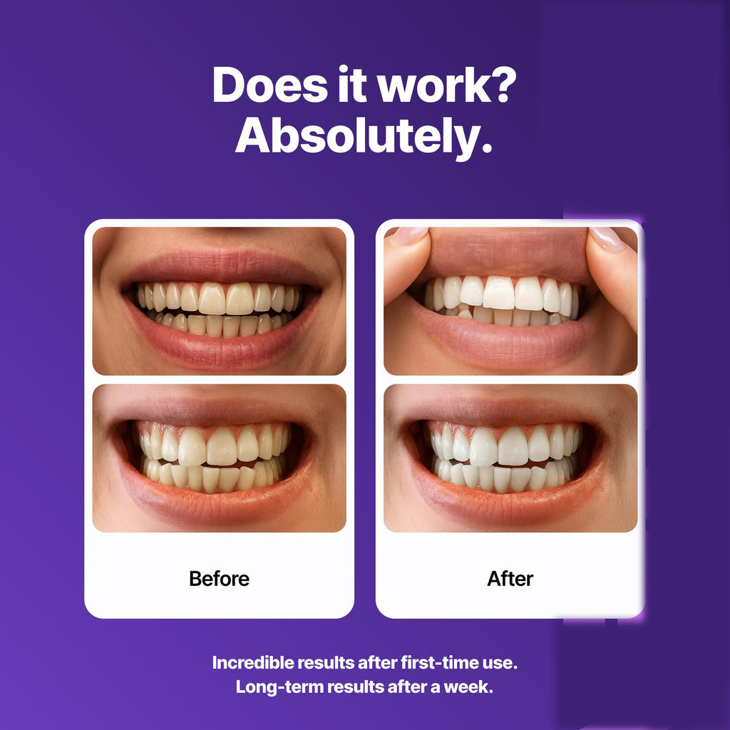 V34 purple colour corrector serum for yellow teeth - detail photo 4