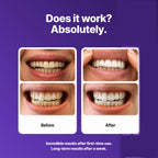 V34 purple colour corrector serum for yellow teeth - detail photo 4