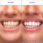 Daily teeth whitening strips, enamel-safe - detail photo 2