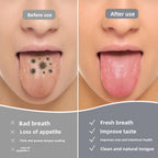 U-shaped tongue scraper, bad breath remedy - detail photo 4